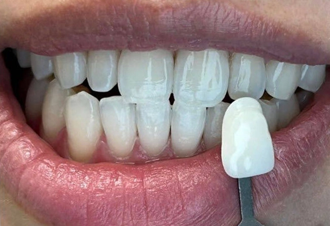 Whitening Case